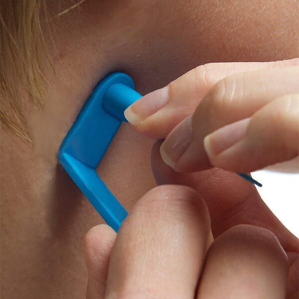 Skin Tag Removal Device, Meat Mole Removal, Corn Removal