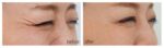 Household facial mask photon acne rejuvenation instrument - Image 4