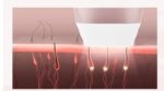Laser Hair Removal Equipment Photon Skin Rejuvenation Hair Removal Equipment - Image 4