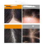 Breathable Bio Scalp Bionic Film Men's Real Hair Replacement Block - Image 3