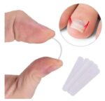 Dedicated Ingrown Nail Orthodontic  Correction Patch Inflammation Manicure Clippers - Image 6
