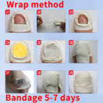 Grey Nail Remover Pedicure Tool - Image 2